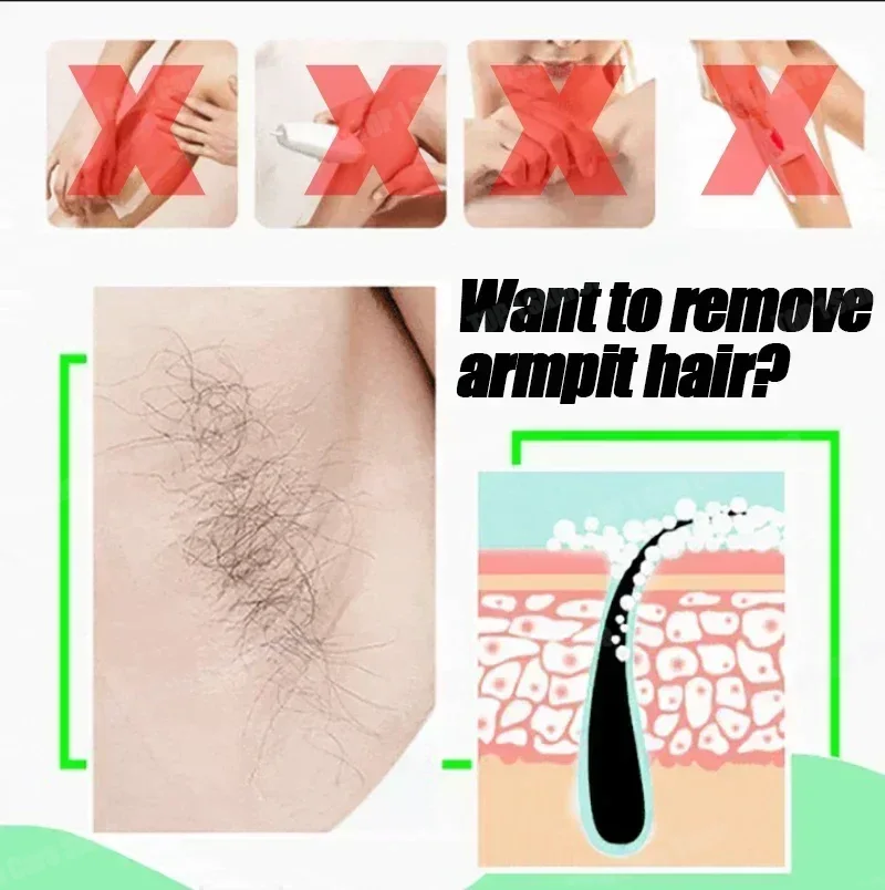 脱毛スプレー 強力な除毛効果 健康的で痛みのない脱毛抑制剤  - Hair Care Korean Products のレビューと価格