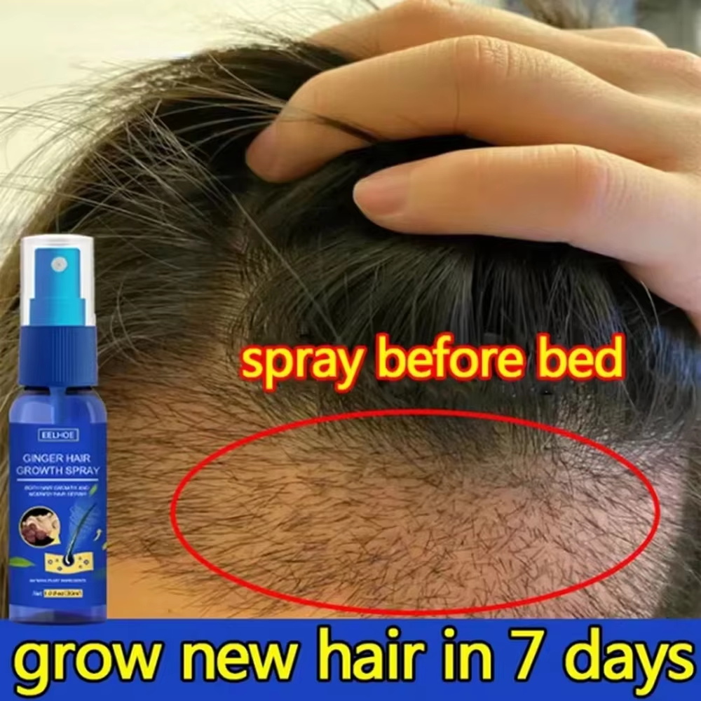 速効性ジンジャーヘアグローススプレー、毛根育成、脱毛防止、育 - Hair Care Lotion のレビューと価格