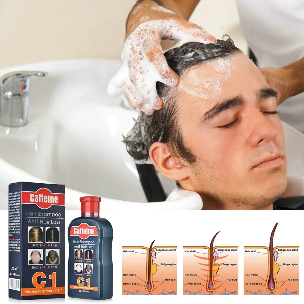 男性シャンプー育毛のための天然植物カフェイン抗脱毛フケ栄養ケ - Hair Care Korean Products のレビューと価格